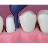 Astringent Retraction paste 25 cps 3M 56944