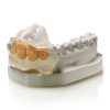 Elite Transparent cartuccia 50 ml silicone Indicato per la realizzazione di mascherine Zhermack C401600